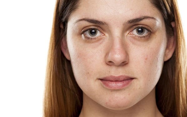 Microdermabrasion for dull and tired skin