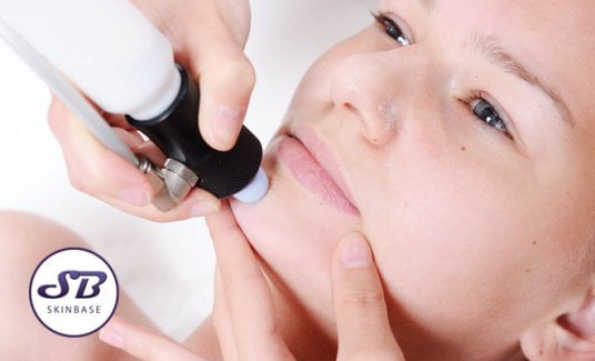Are microdermabrasion results permanent