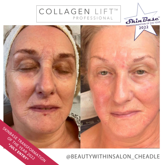 BEAUTYWITHIN COLLAGEN LIFT FACIAL