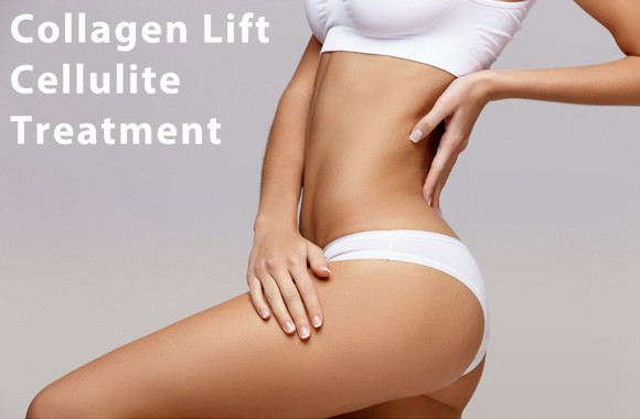 Collagen Lift Cellulite Treatment