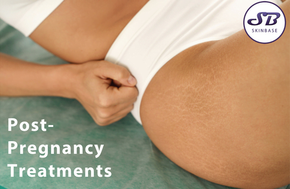 post-pregnancy treatments