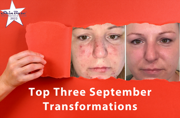 September Transformations
