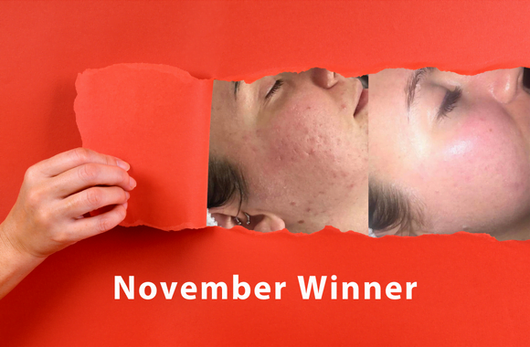 November Winner